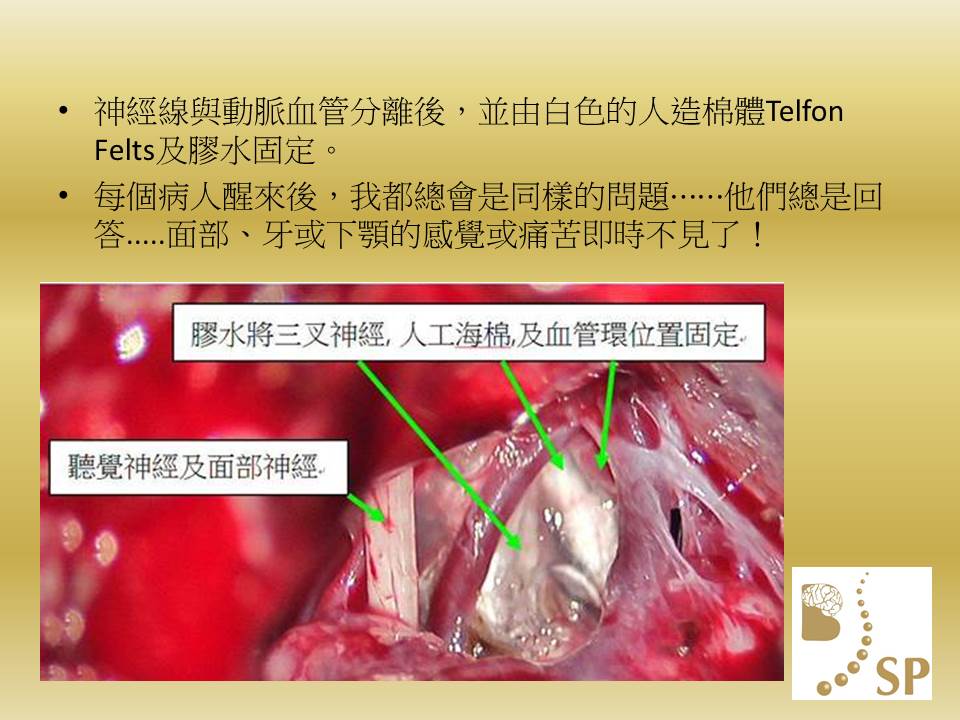 Slide4
