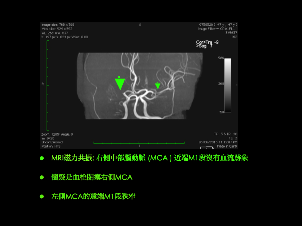 slide003