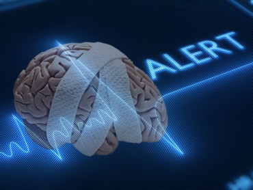Stroke Alert