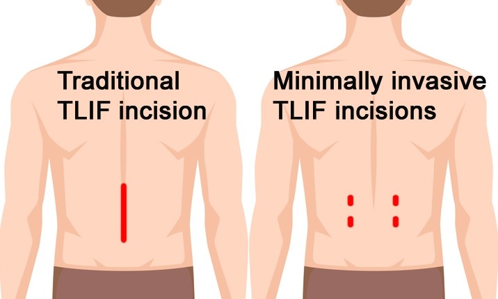 Spine Surgeon Comparison