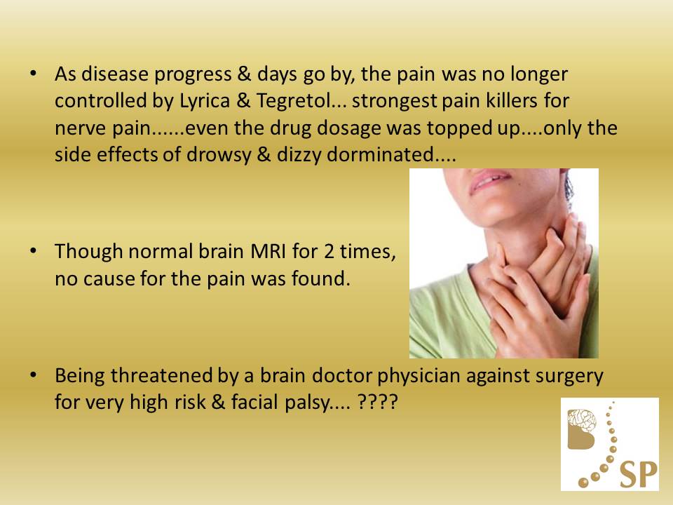 Trigeminal Neuralgia Surgeon Case